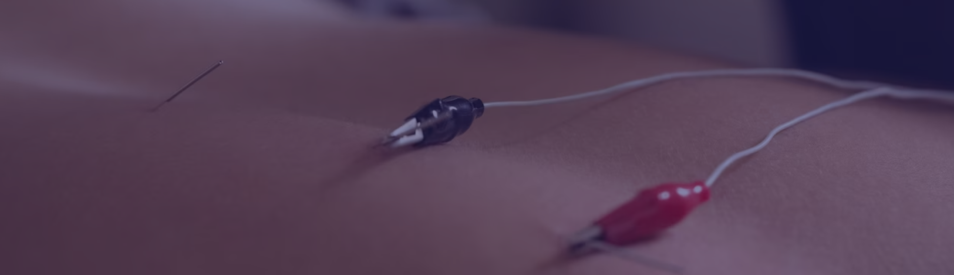 about-banner